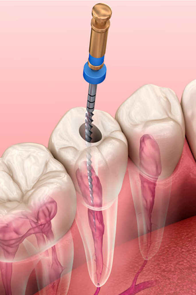 Endodontia