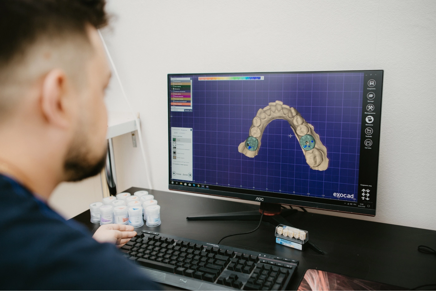 Работа с 3D моделью в программе exocad