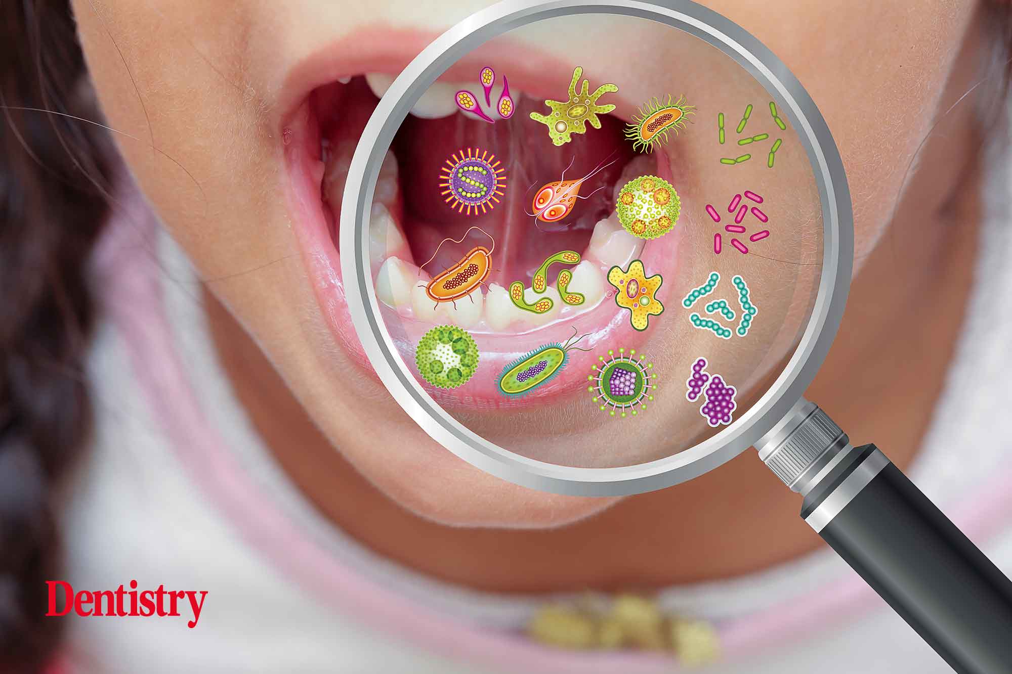 Advancing an understanding of the oral microbiome - Dentistry