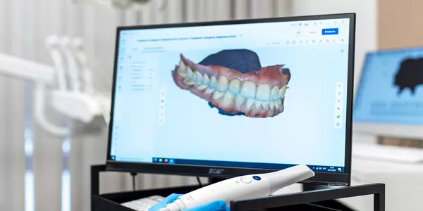 3D сканирование зубов в клинике