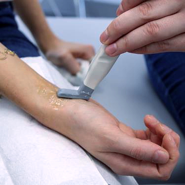 Wrist and hand ultrasound examination