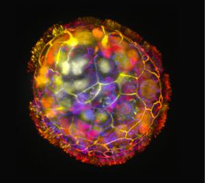 Anthrobot microscópico formado por células humanas traqueais com cílios visíveis em microscopia confocal
