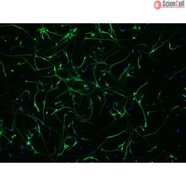 Cultura de neurônios humanos em fluorescência mostrando redes neurais em desenvolvimento
