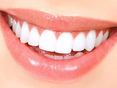 Teeth Whitening | Henderson NV Dentist | Smile Shop Dental