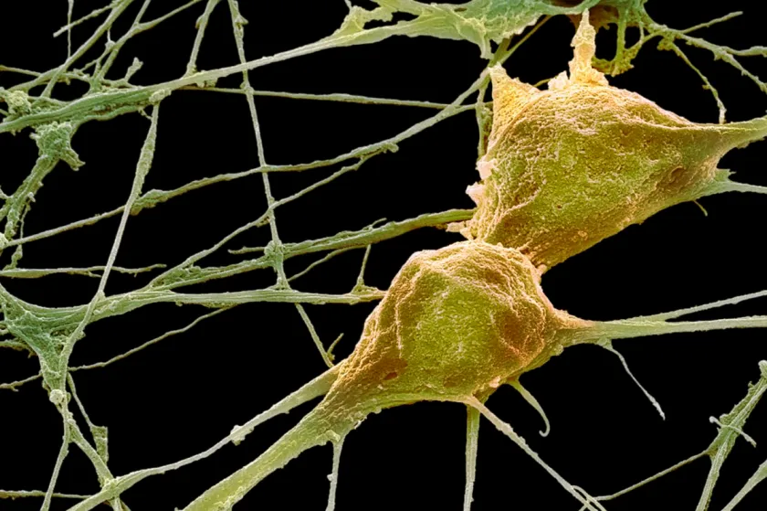 Micrografia eletrônica de varredura mostrando neurônios humanos em alta resolução com detalhes de sinapses