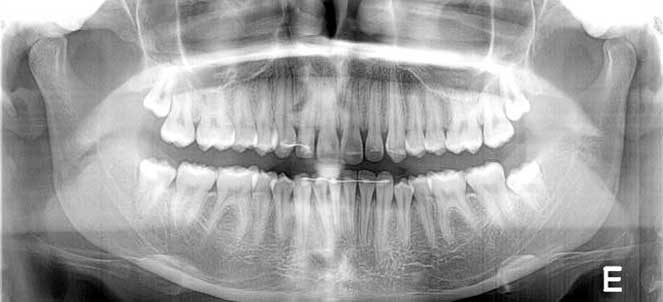 Radiologia e Imaginologia Odontológica